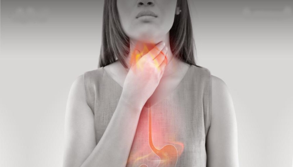Gastroesophageal Reflux Disease and heartburn